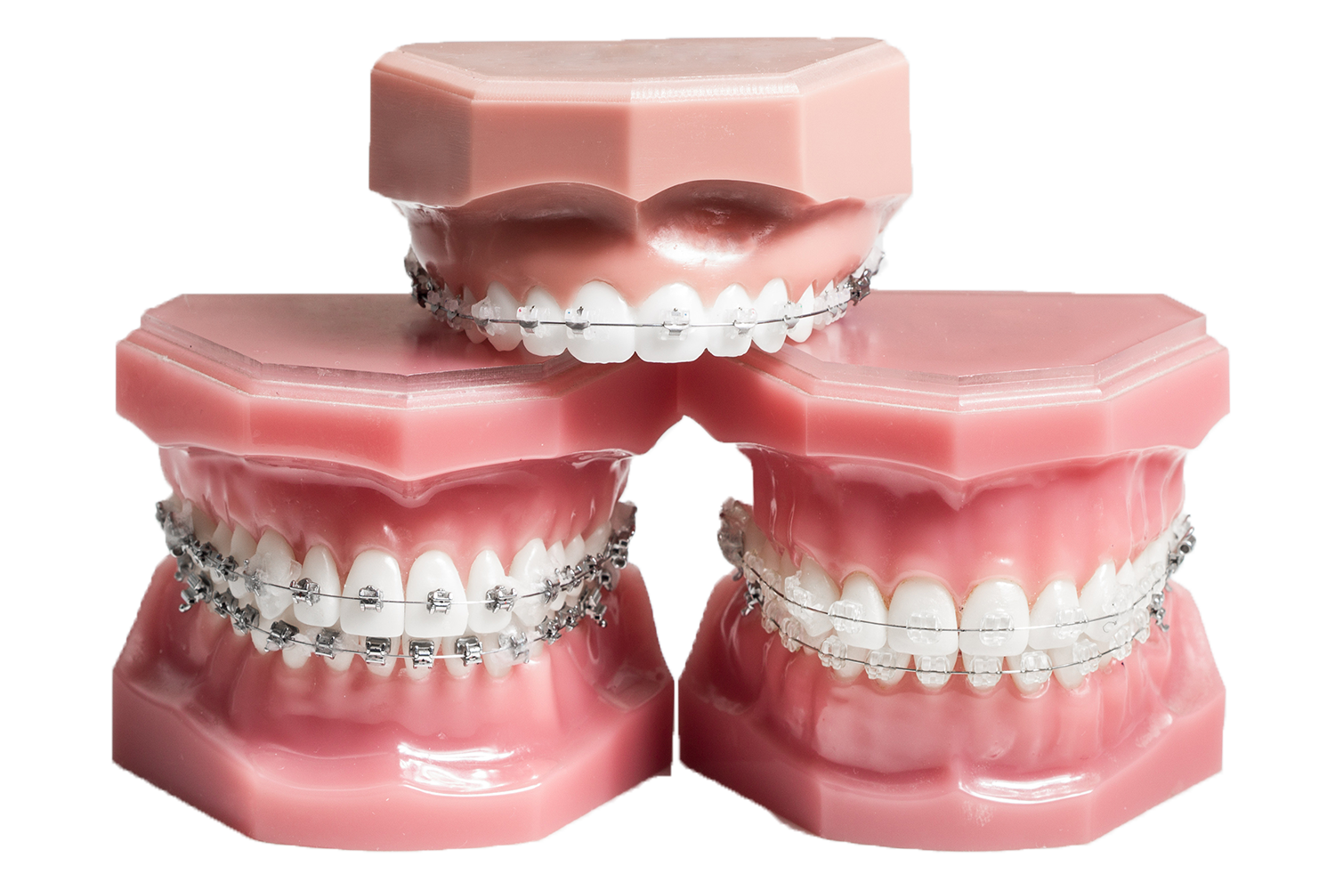 SelfLigating Braces HRS Dental Care in Gloucestershire